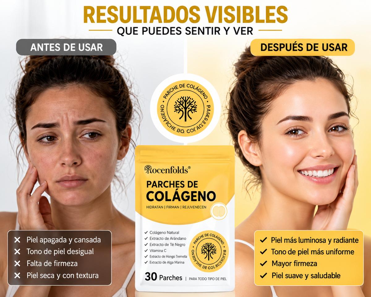 Ingredientes de la fórmula de parches de colágeno Acentia Labs